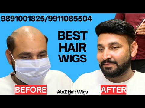 Your wig: The secret to beautiful hair 2025