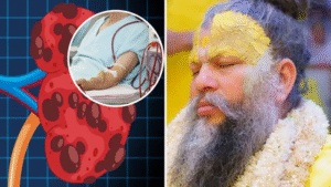 Premanand Ji Maharaj Health Update 2025: